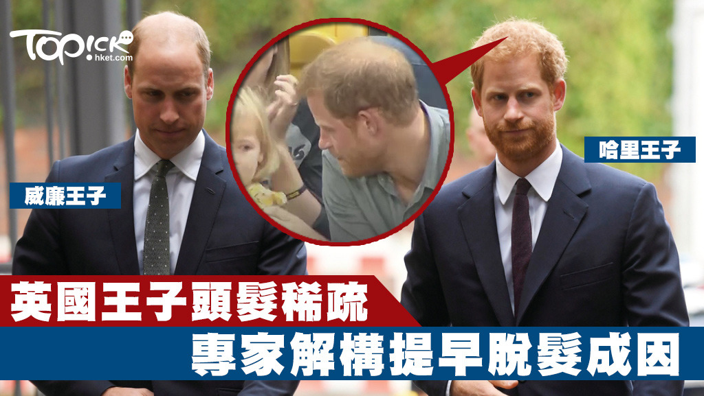哈里王子头发稀疏 男人为什么容易脱发 原因是什么引起的 头发油多易脱发-汇美优普